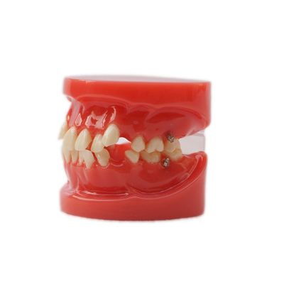 প্রশিক্ষণ ব্যবহার দাঁত দাঁত শিক্ষা মডেল ফাংশনাল দাঁত Orthodontic মডেল বন্ধনী ছাড়া