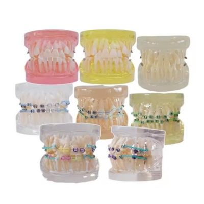 অধ্যয়নের জন্য মাল্টি রঙিন মানব দাঁত মডেল দন্তের অর্থোডন্টিক দাঁত মডেল ব্র্যাকেটের সাথে