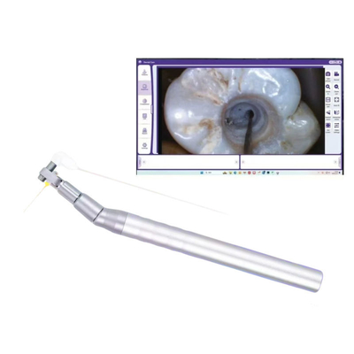 ভিজ্যুয়াল ডিজিটাল ডেন্টাল মাইক্রো ক্যামেরা রুট ক্যানাল চিকিত্সার জন্য ইনট্রোরাল এন্ডোস্কোপ